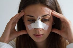 Broken nose compensation guide