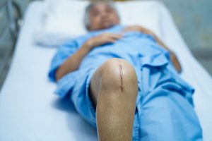 A man with a scar on his knee lies on a hospital bed.