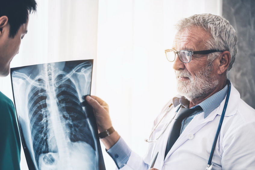 How Much Compensation For Fractured Skull Pasadena thumbnail