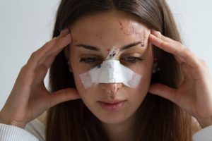 nose injury compensation calculator