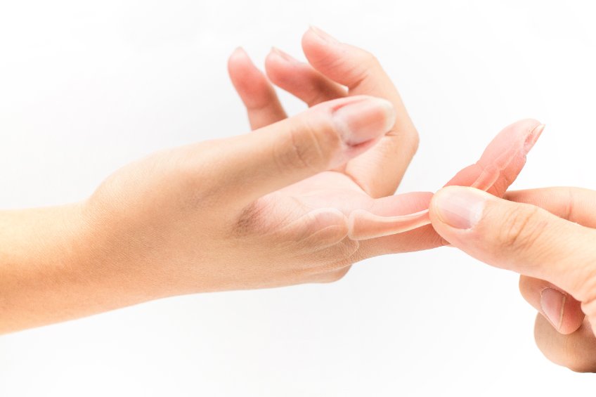 Lakewood Cut Finger Tendon Compensation thumbnail