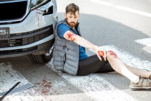 pedestrian hit on zebra crossing