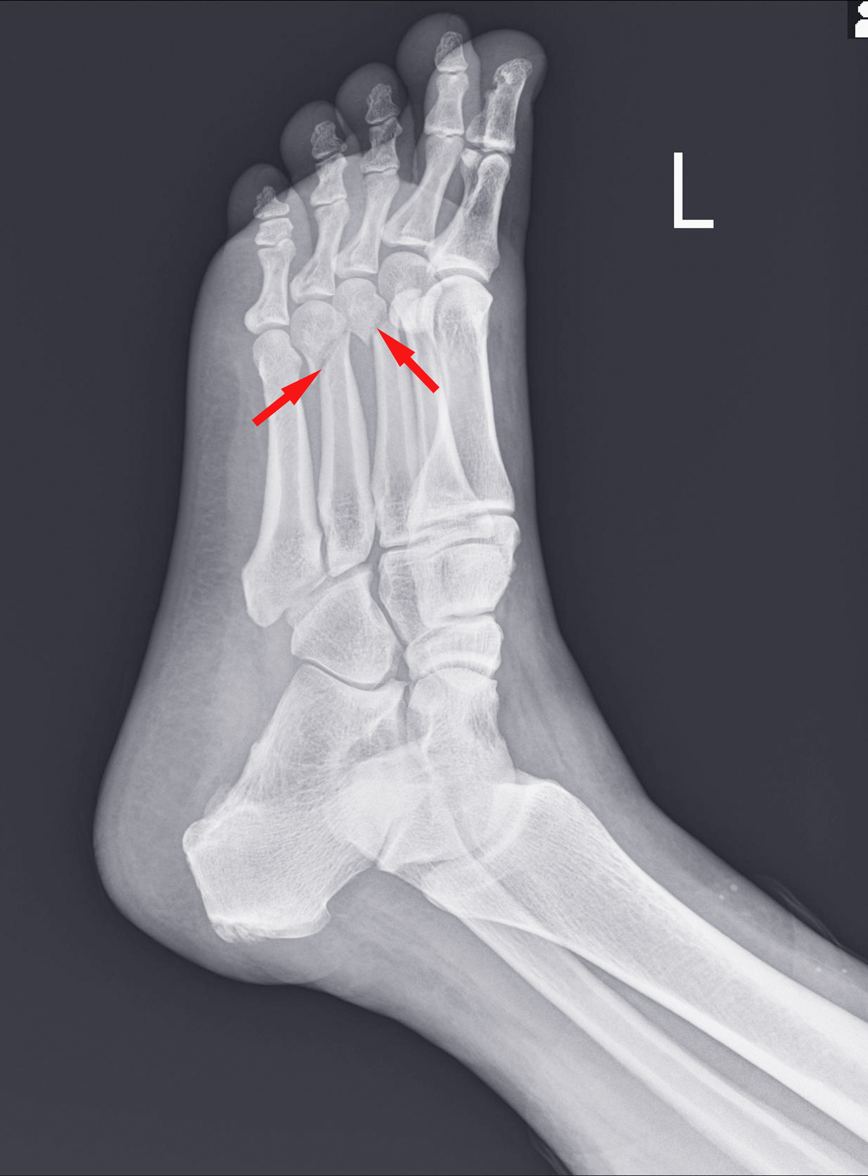 Kitűző - X-ray Cica Kitűző - X-ray Cica