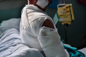 A SEVERELY BANDAGED PERSON SUFFERING MULTIPLE INJURIES