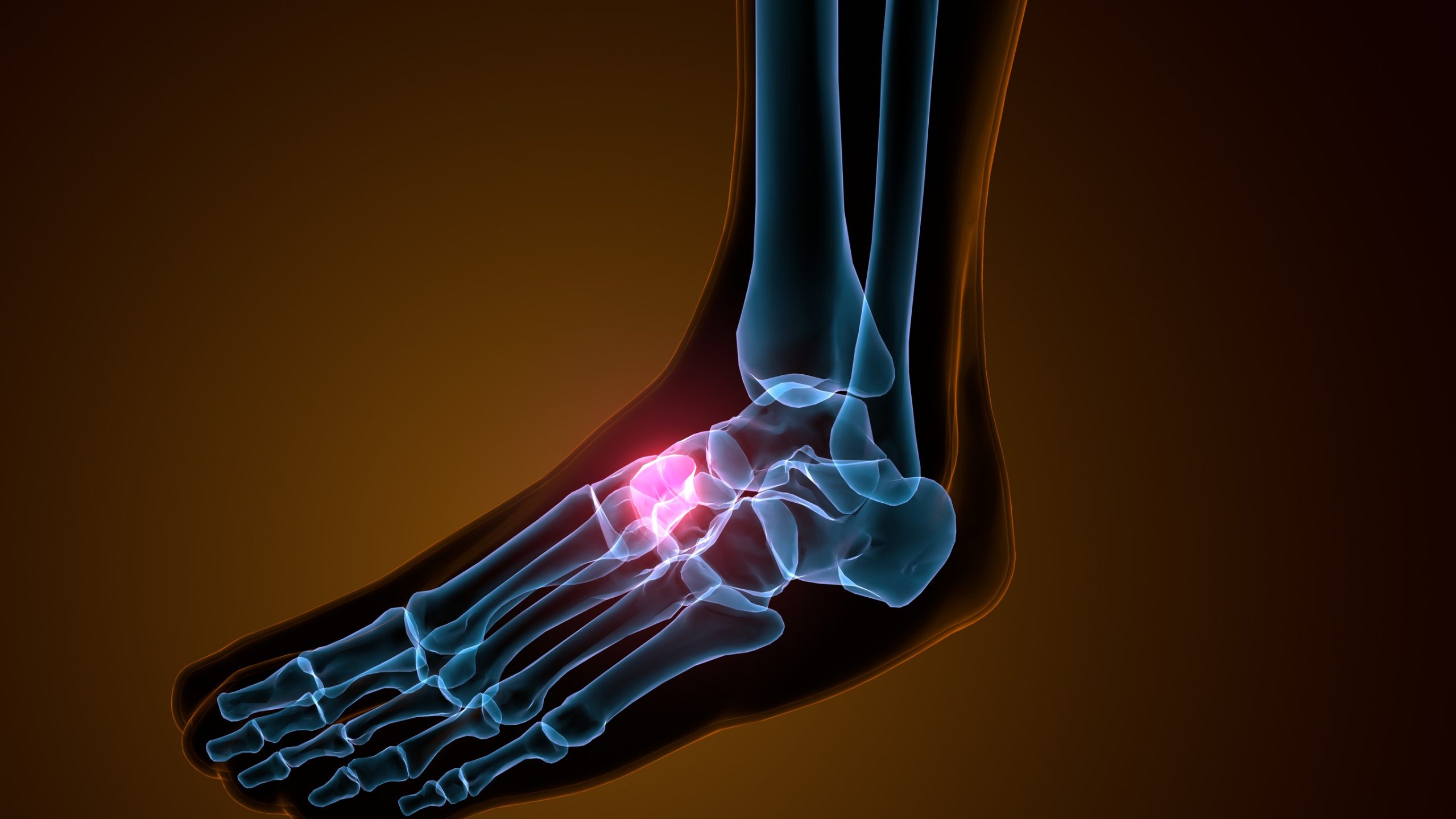 Foot Injury Claim Calculator - How Much Compensation Could You Claim?